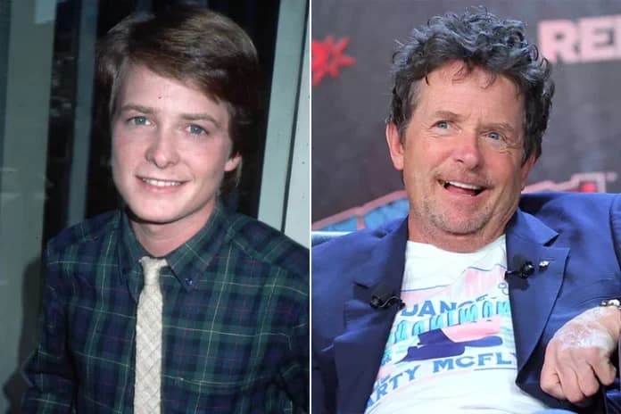 Are Celebrity Transformations Always For The Best? See The Biggest Stars’ Before-And-After Pictures