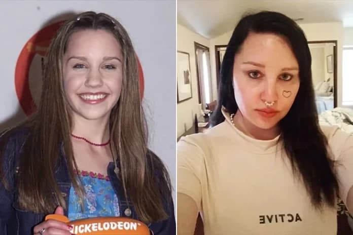 Are Celebrity Transformations Always For The Best? See The Biggest Stars’ Before-And-After Pictures