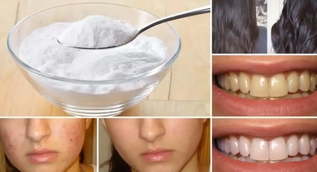 Baking Soda