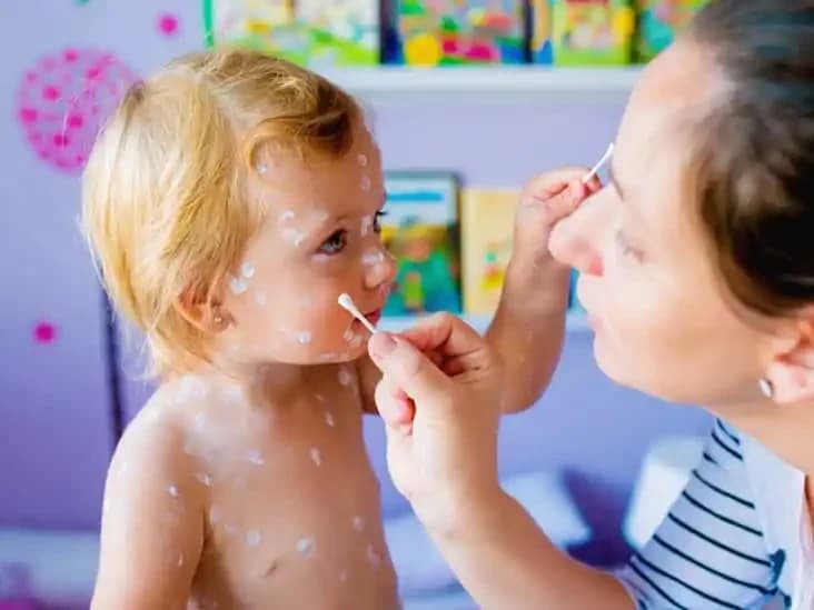 Baking Soda
