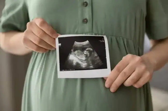Beth Was Pregnant