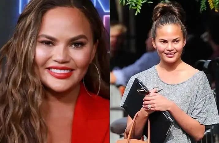 Chrissy Teigen
