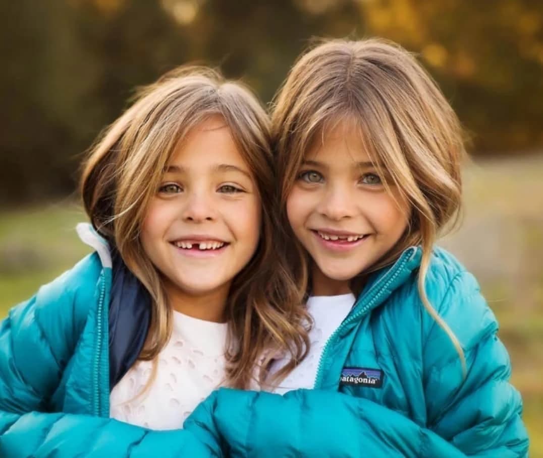 They were considered the most beautiful twins in the world: but what happened to the beautiful girls?