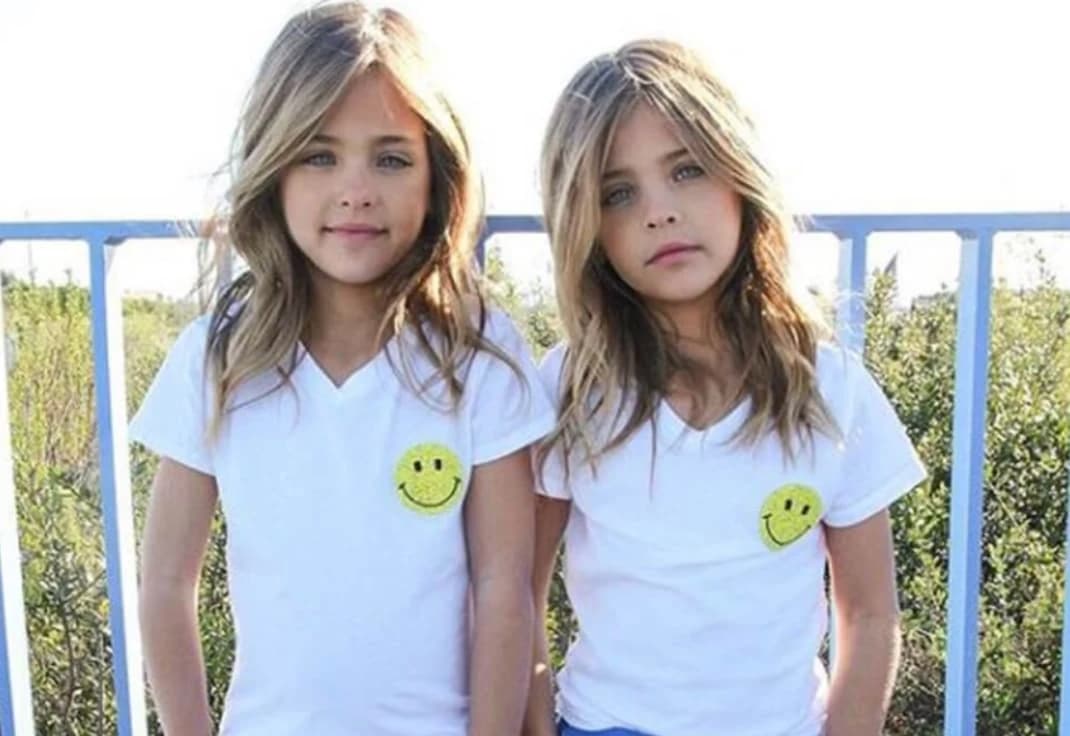 They were considered the most beautiful twins in the world: but what happened to the beautiful girls?