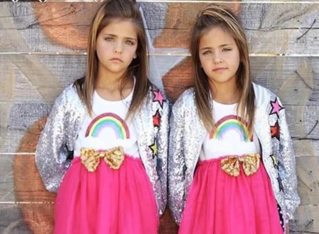 They were considered the most beautiful twins in the world: but what happened to the beautiful girls?