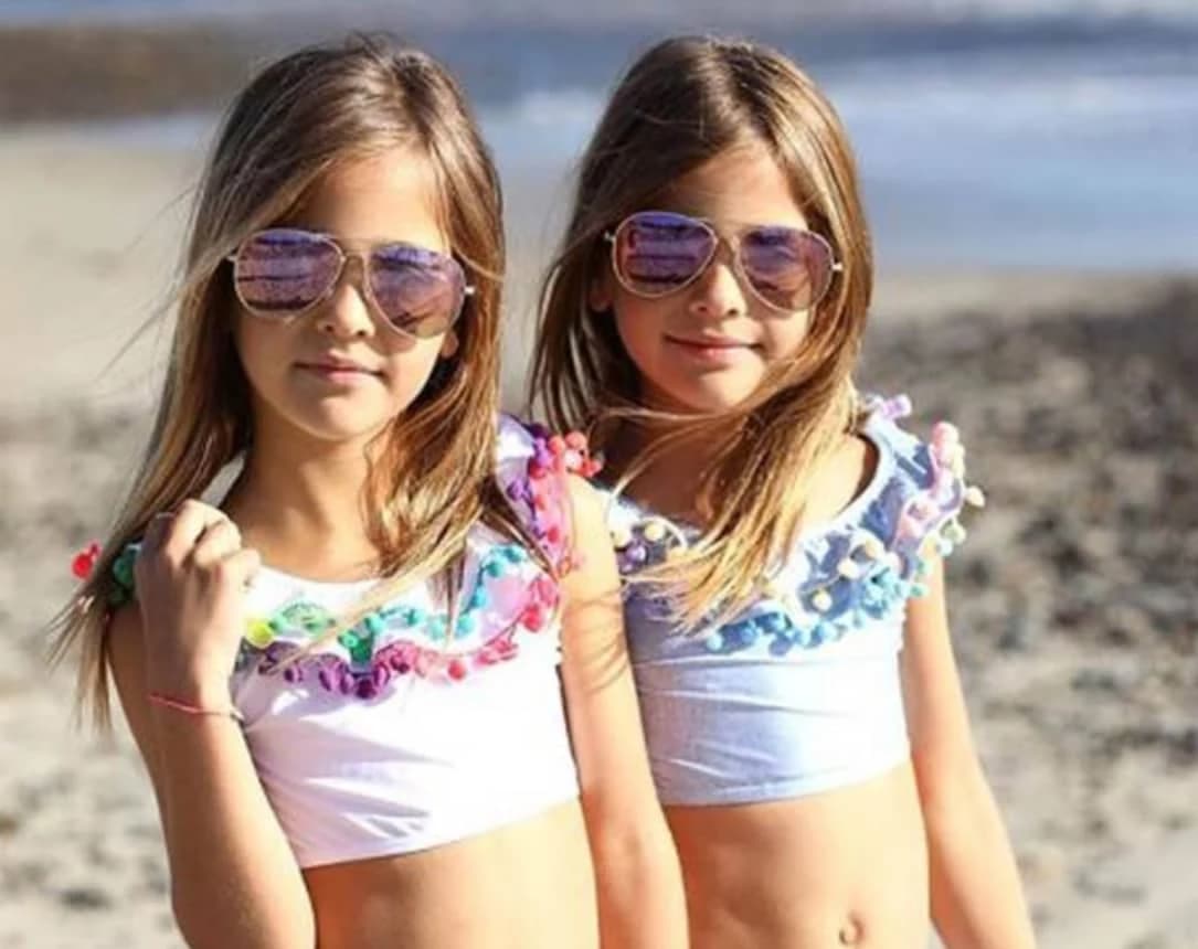 They were considered the most beautiful twins in the world: but what happened to the beautiful girls?