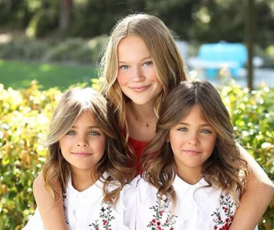They were considered the most beautiful twins in the world: but what happened to the beautiful girls?