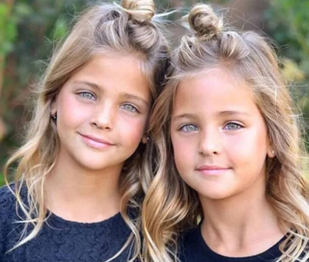 They were considered the most beautiful twins in the world: but what happened to the beautiful girls?